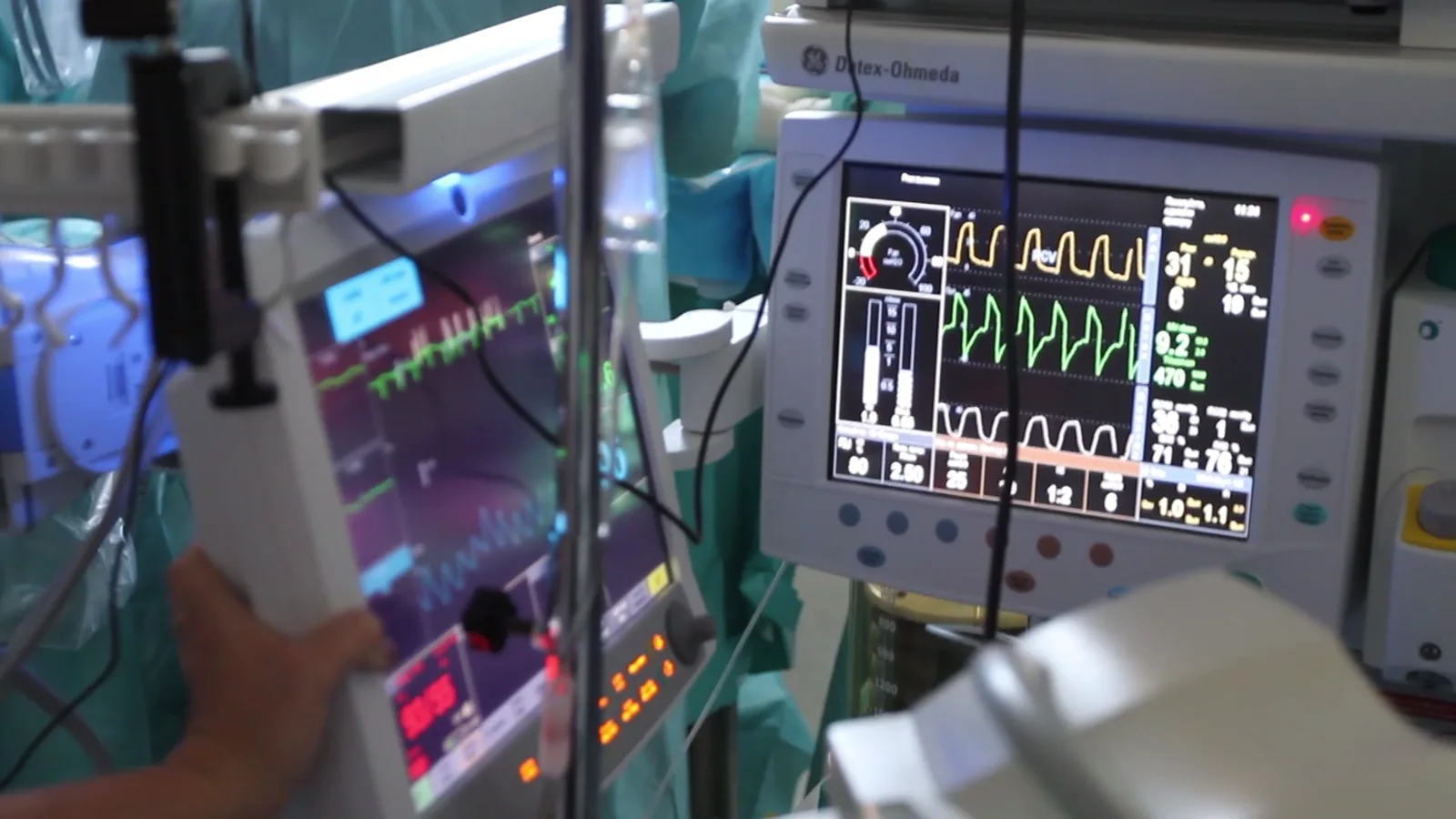 Illustrative stock footage of perioperative monitoring equipment